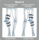 Knee orthosis Bort OA-Xpress Modell B