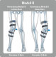 Knee orthosis Bort OA-Xpress Modell B