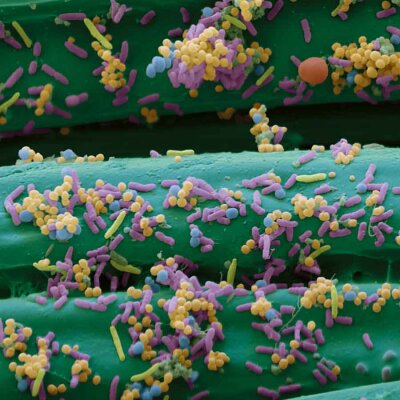 BSN medical Cutimed Sorbact Tamponaden 12 x 5x200cm